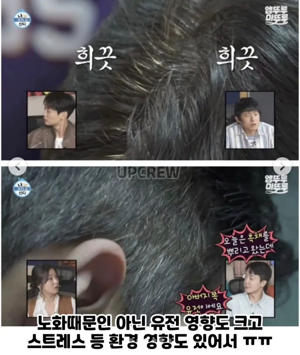 조인성 피셜:염색 안하면 옆머리 전부 새치 (+유아인 외 새치 연예인 모음) (7/13)