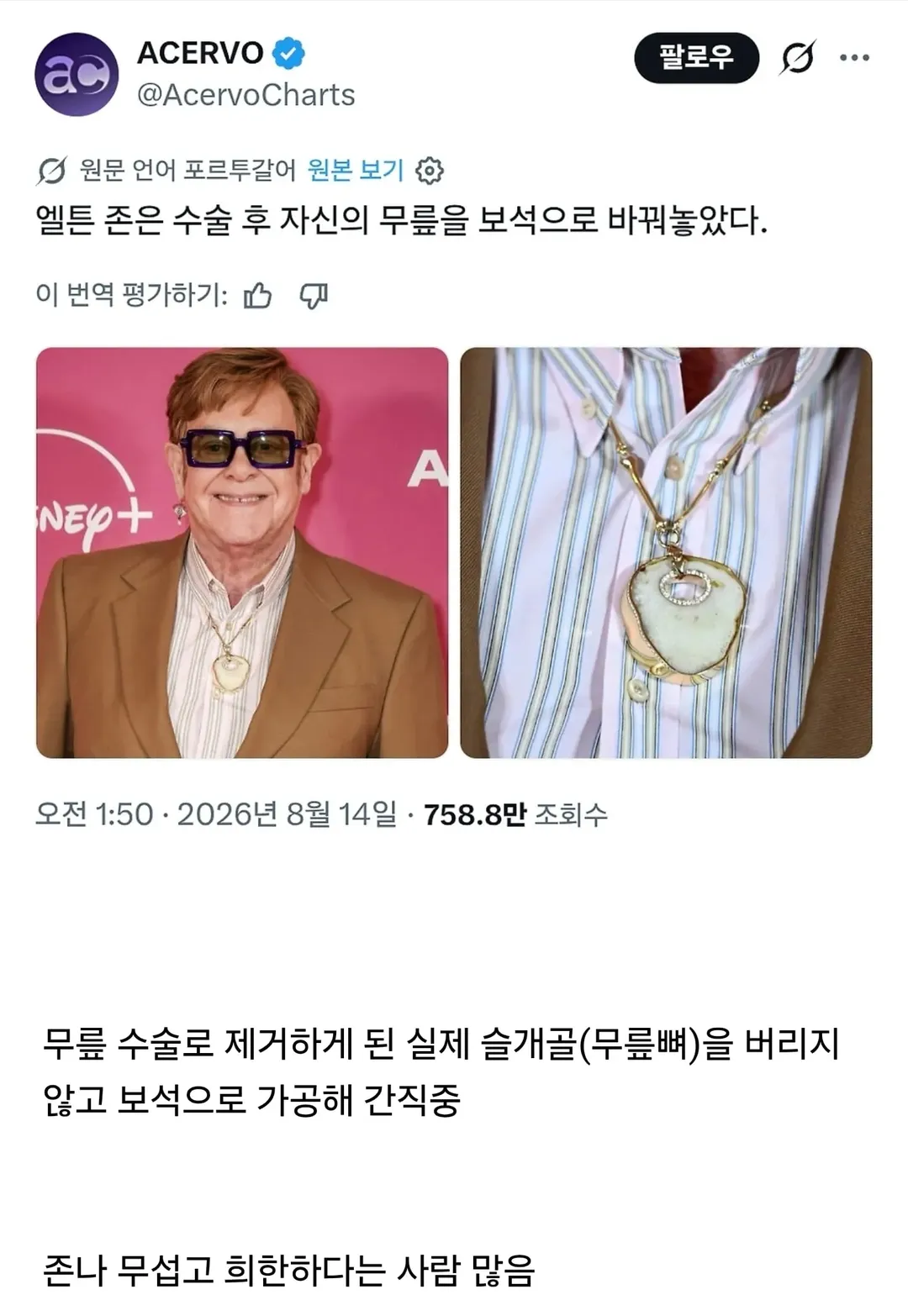 무섭다는 반응 많은 엘튼존 목걸이 (2/2)