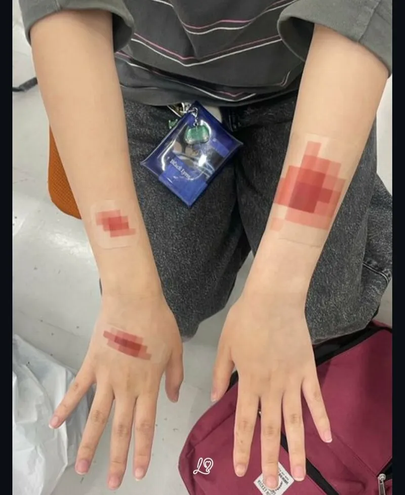 이슈) 일본에서 화제라는 모자이크 반창고.jpg (2/3)