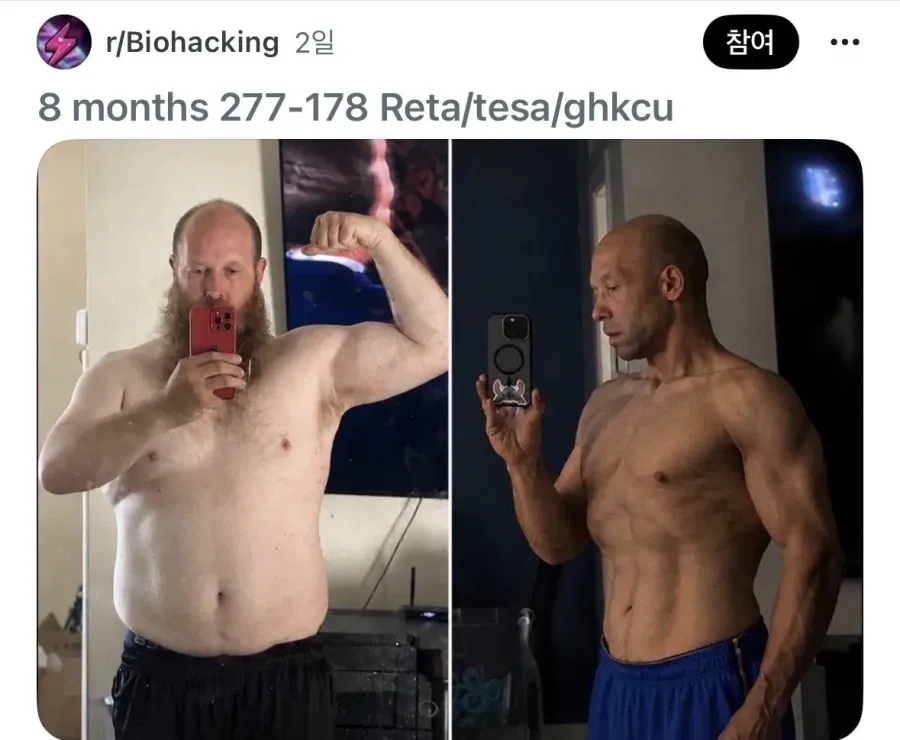 마운자로보다 더 좋은 약을 8개월동안 맞은 결과... ㄷㄷㄷ