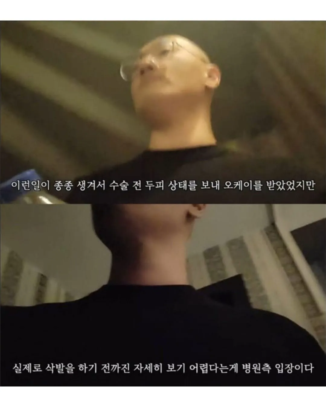터키로 모발이식 받으러간 남자의 최후.jpg (5/6)