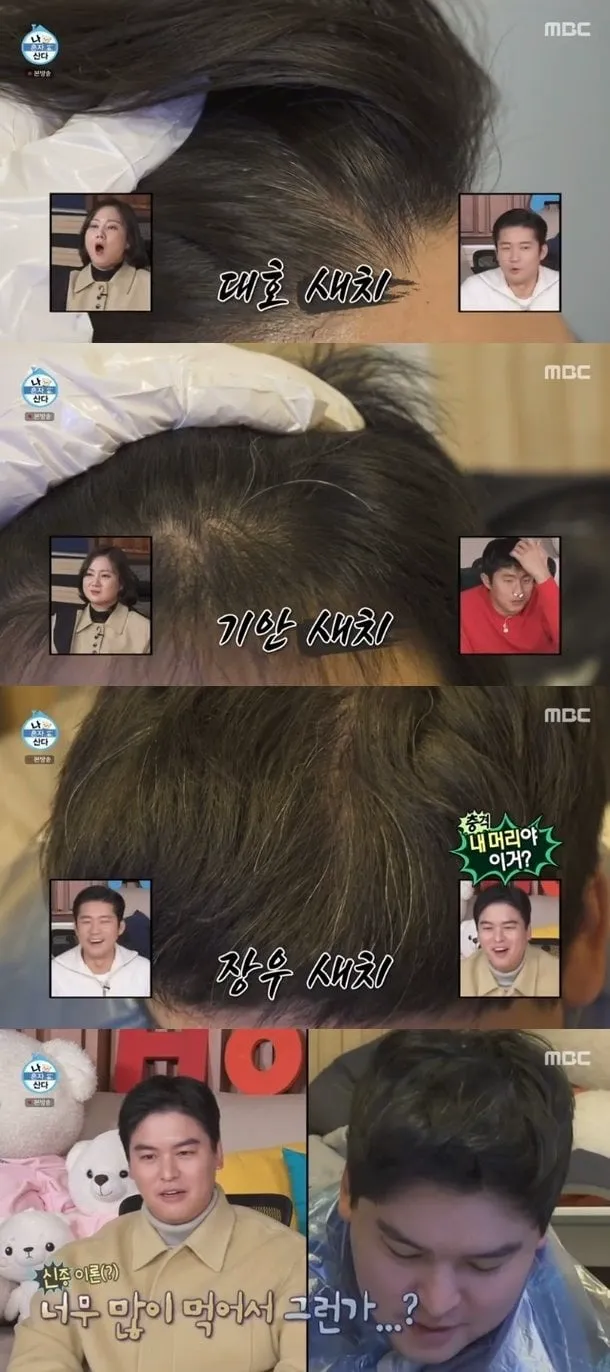 조인성 피셜:염색 안하면 옆머리 전부 새치 (+유아인 외 새치 연예인 모음) (5/13)