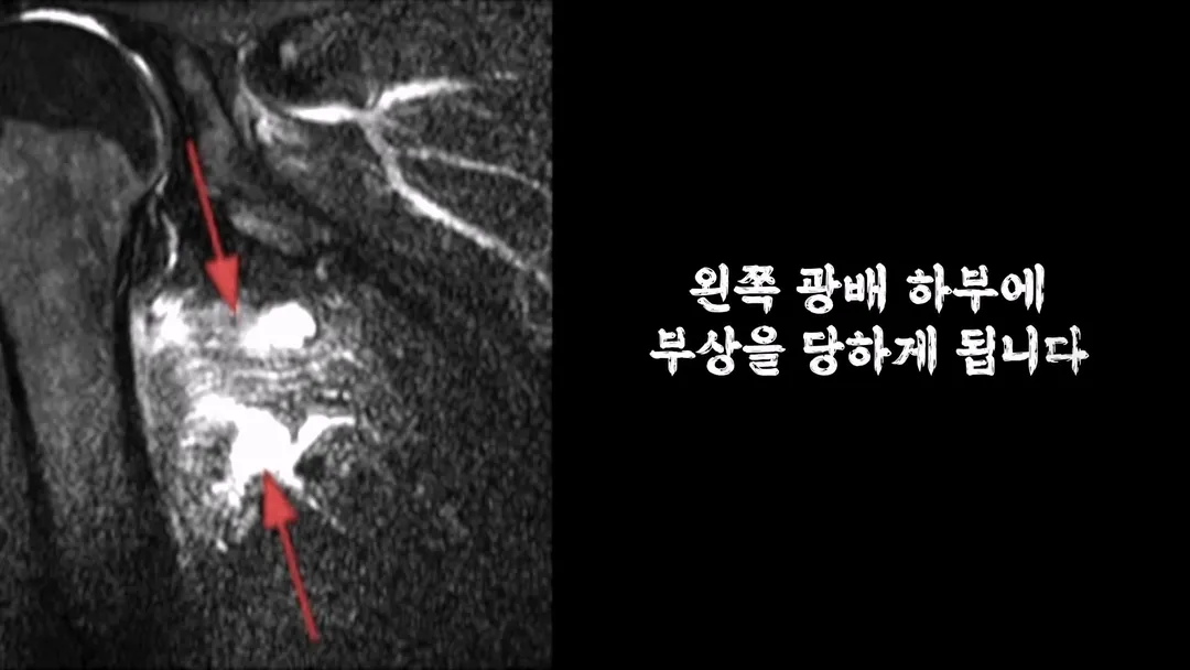 몸무게 46kg 남성의 3674일간의 헬스 기록 (8/19)