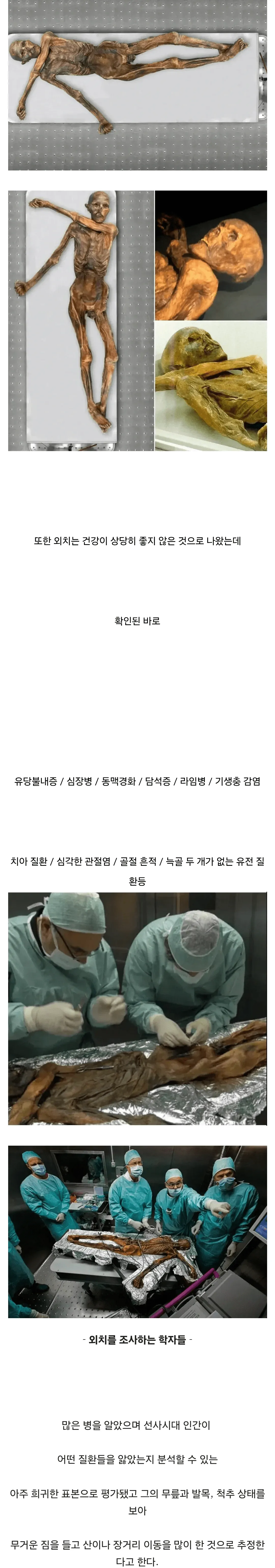 싱글벙글 얼음 속에서 5000년 넘게 잠들어 있던 미라 이야기 (3/7)