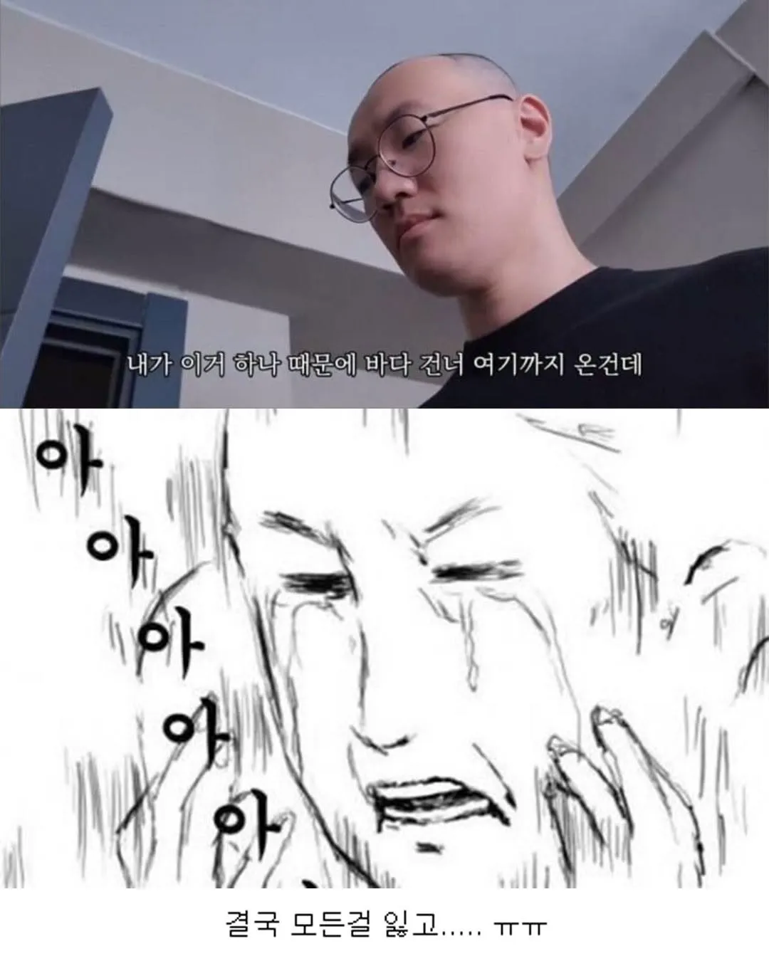 터키로 모발이식 받으러간 남자의 최후.jpg (6/6)